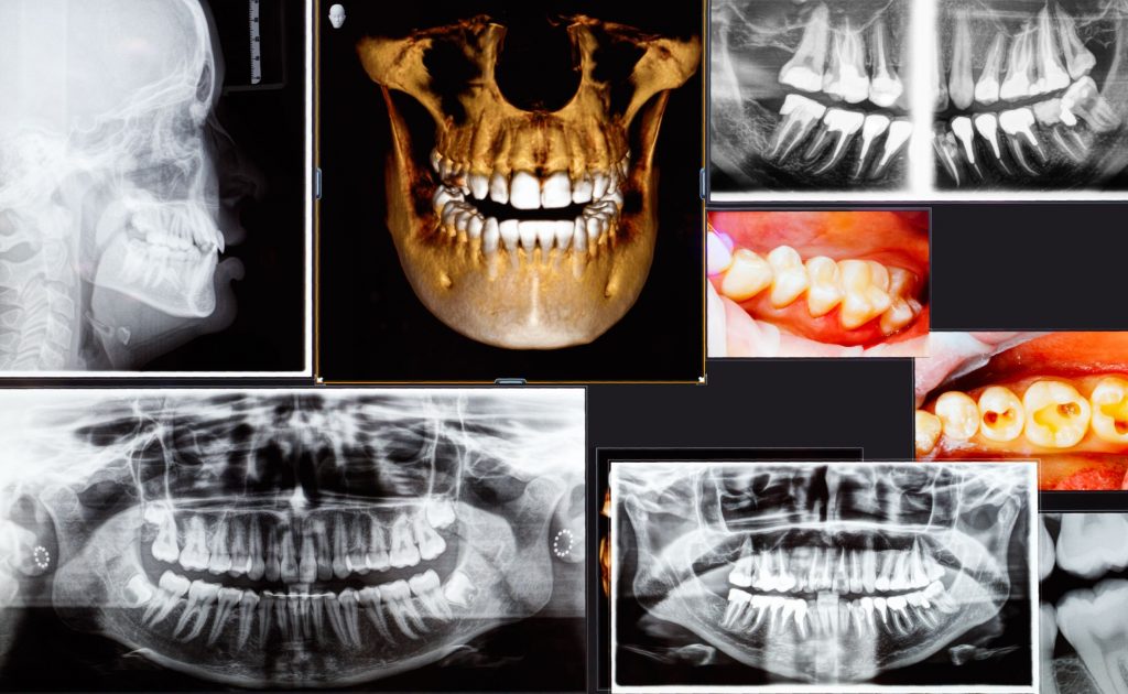 dental-digital-impressions-scan